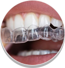 Braces & Invisalign