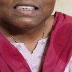 after dental image