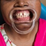 before dental image